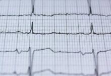 omega circuit 915412530 strategic pulse